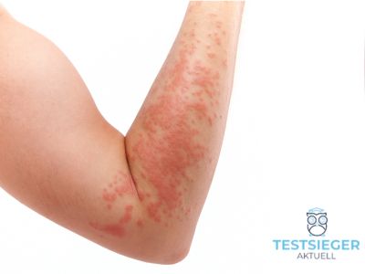 Wie bestimmen Verbraucherorganisationen die Sonnencreme fuer Allergische-Haut Testsieger